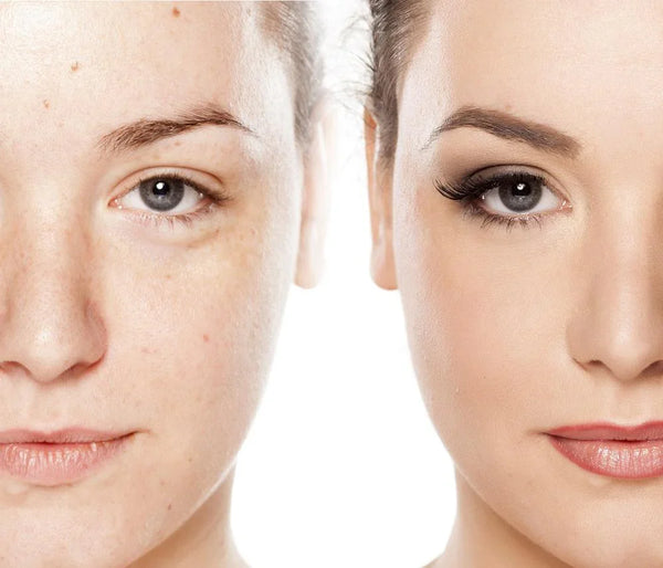 Before and after comparison of skin hydration and texture